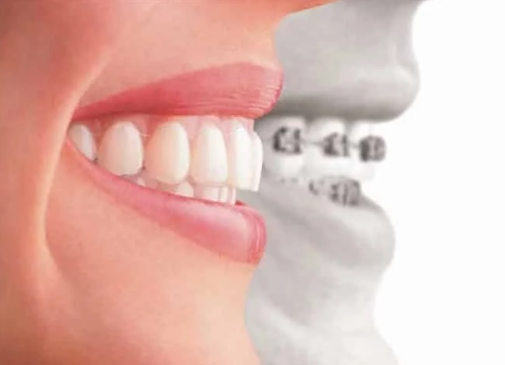 aparelho odontológico em Brasília