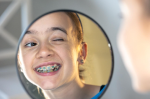 como escovar os dentes com aparelho